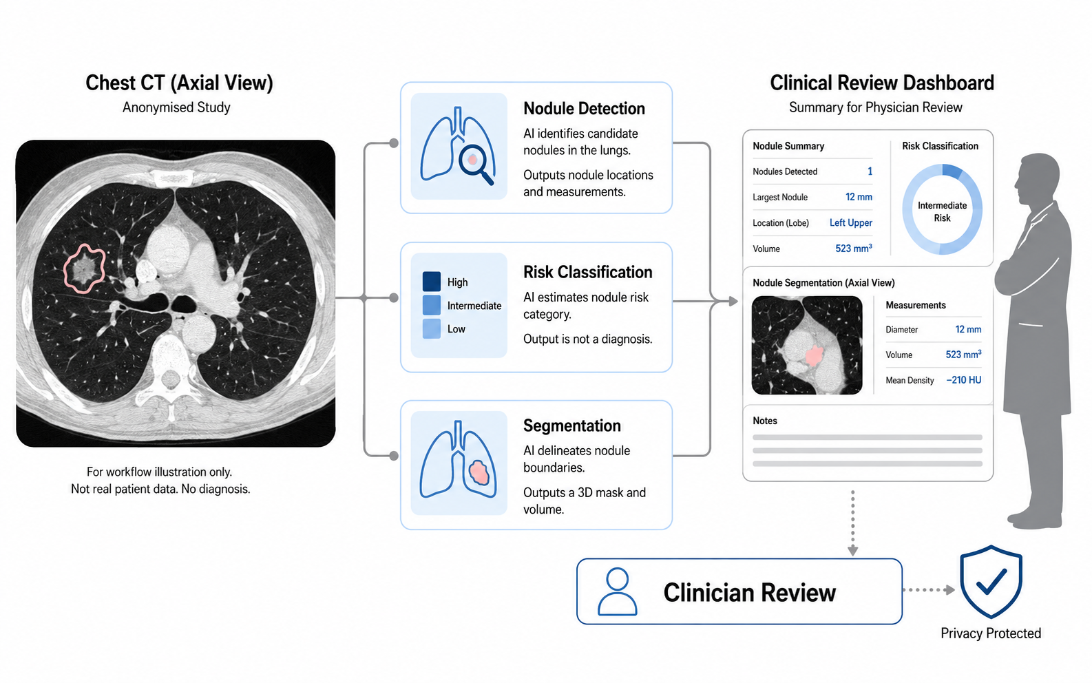 PulmoSight: Lung Cancer Rapid Screening & Triage project overview illustration